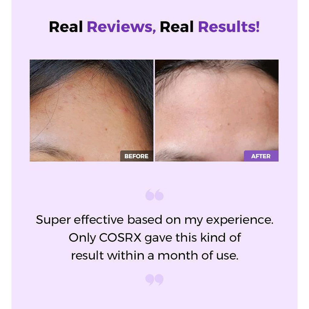 COSRX AHA/BHA Treatment Toner 150 ML