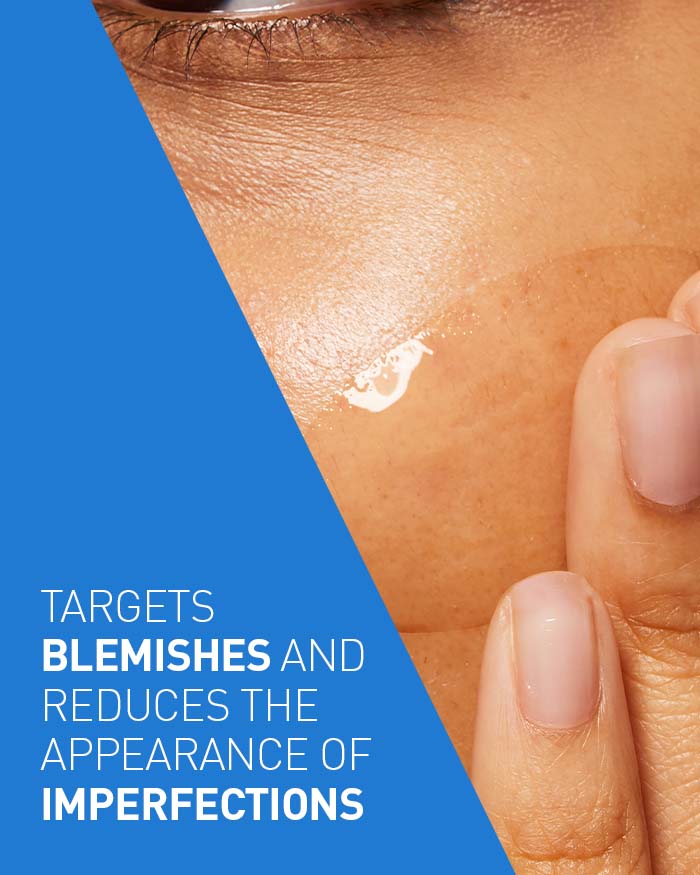 Acne Control Gel 40ML